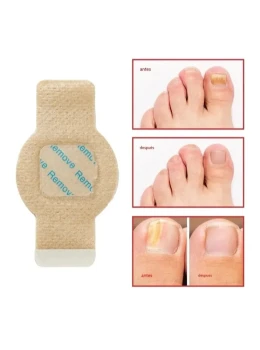 Adesivos Tratamento Fungos Unhas Eficazes
