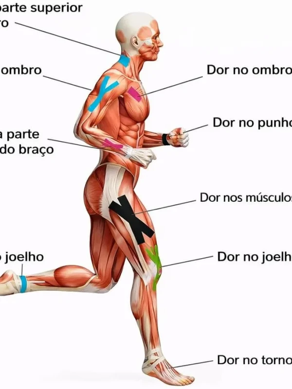 Fita Kinésio Terapêutica Alta Qualidade Colorida
